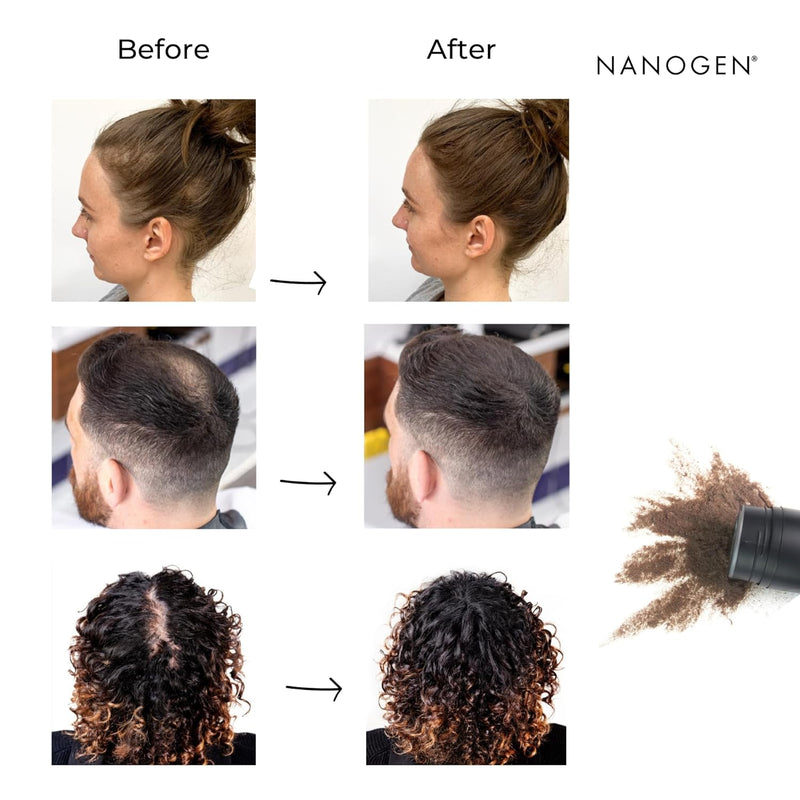 Nanogen Keratin Hair Fibres 15 Grams Shade No. 05 (Medium Brown)
