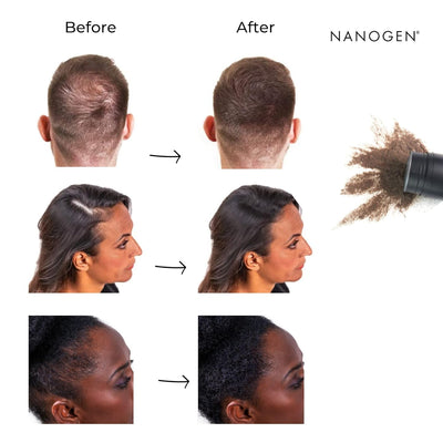 Nanogen Keratin Hair Fibres 15 Grams Shade No. 05 (Medium Brown)