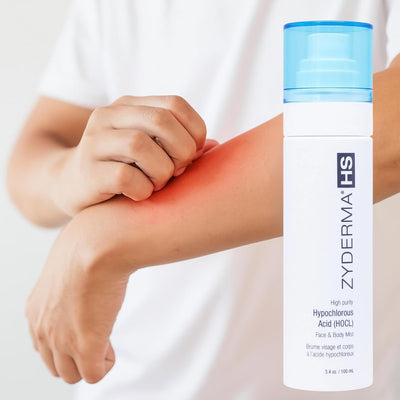 Face & Body Mist HOCl Facial Mist for Sensitive Skin, Redness, Irritation Soothes Skin Fine Mist Spray for Post-Workout, Tattoos Daily Skin Repair Solution 3.4oz