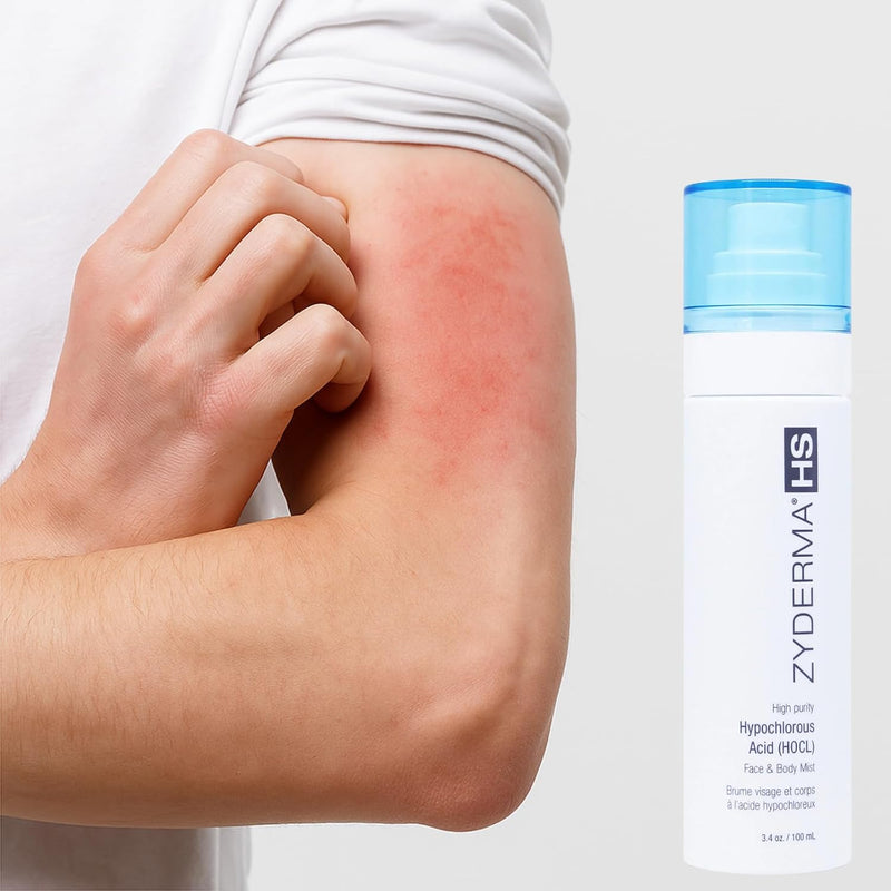 Face & Body Mist HOCl Facial Mist for Sensitive Skin, Redness, Irritation Soothes Skin Fine Mist Spray for Post-Workout, Tattoos Daily Skin Repair Solution 3.4oz